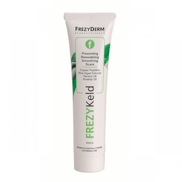 FREZYDERM FREZYKELD CREAM 40ML FREZYDERM FREZYKELD CREAM 40ML
