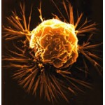 Carcinosinum Carcinosinum
