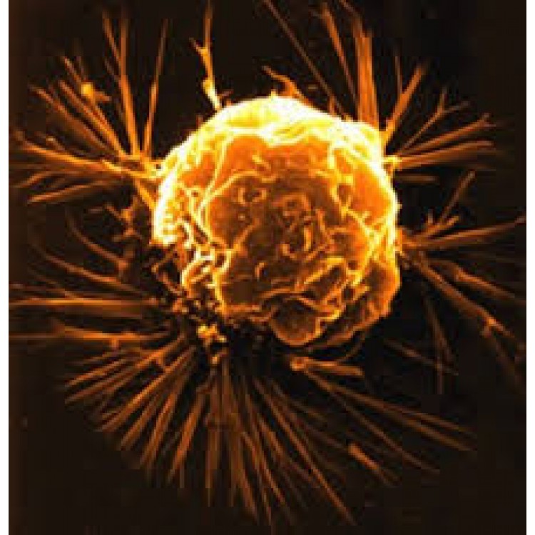 Carcinosinum Carcinosinum