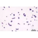 Staphylococcinum Staphylococcinum