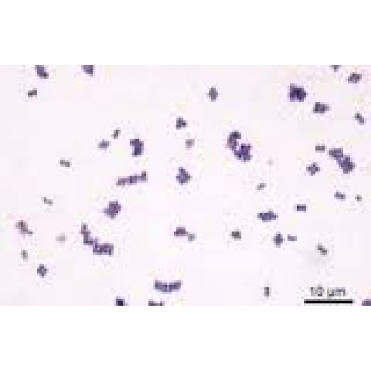 Staphylococcinum Staphylococcinum